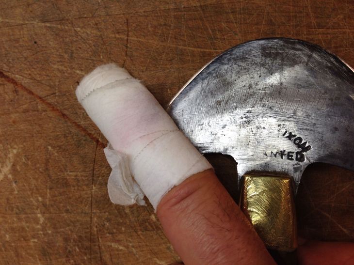 The knife won this round.